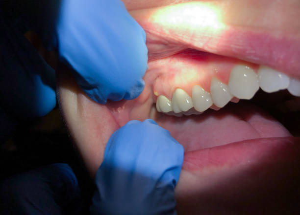 Best 24-Hour Emergency Dentist in Ansted, WV